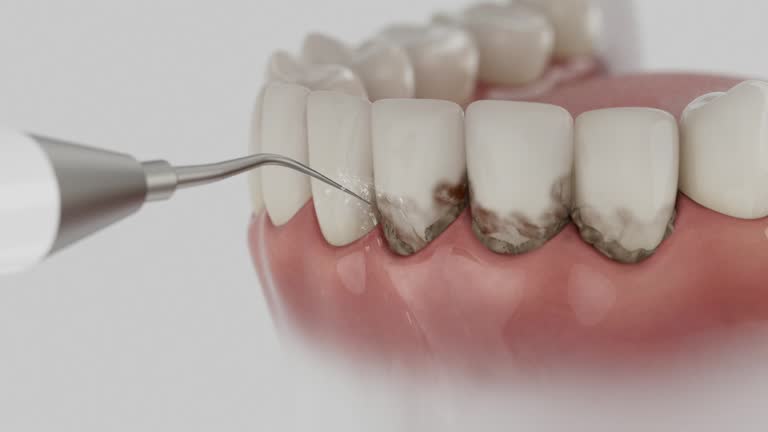 Reliable Dental contractor in Wagoner, OK by Smile Center Dentistry
